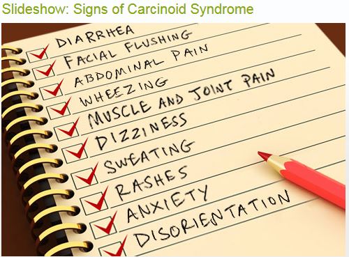 Carcinoid Syndrome Symptoms
