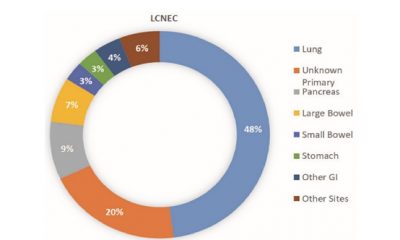 Large cell neuroendocrine tumors distribution by site of origin