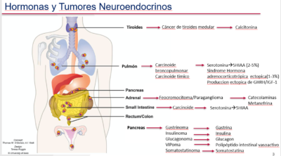 Hormonas y Tumores Neuroendocrinos