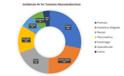 Incidencia de los Tumores Neuroendocrinos